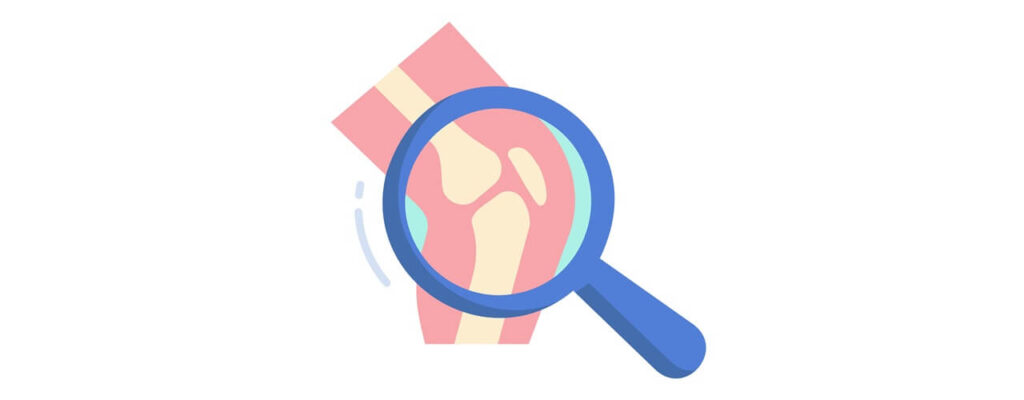 Understanding_Knee_Pain_Causes_Key_Insights_for_Effective_Treatment